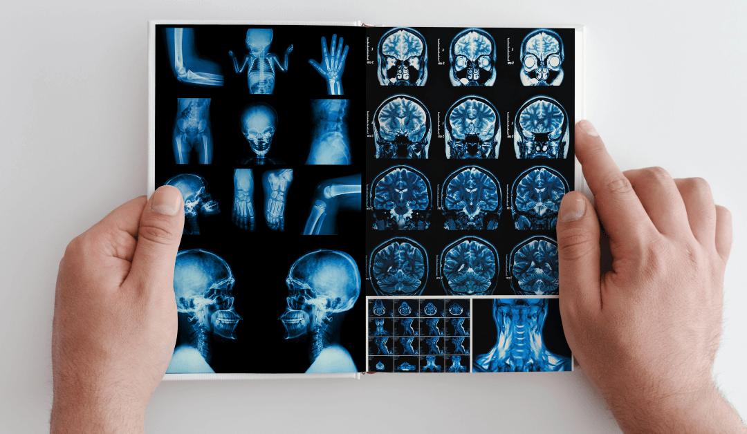 The Important Things You Need To Know About 1.5 And 3 Tesla MRI